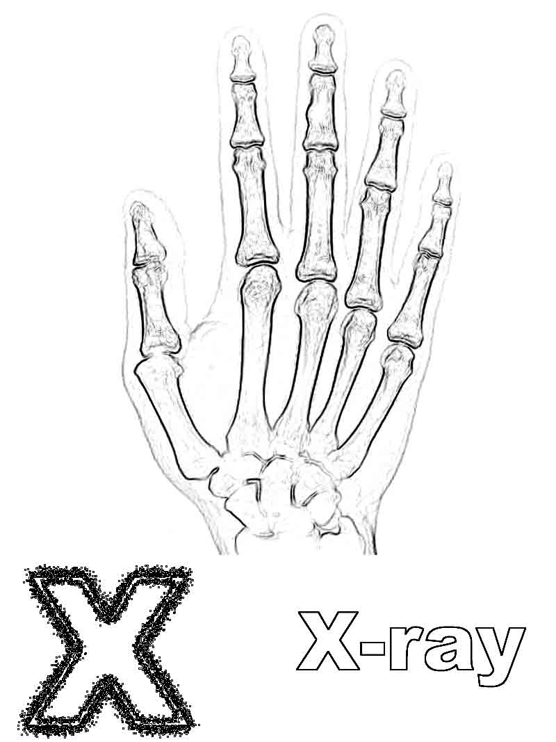 x ray easy drawing - Clip Art Library.