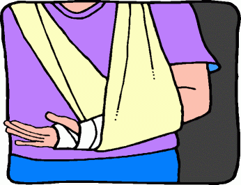 Broken Arm Clip Art