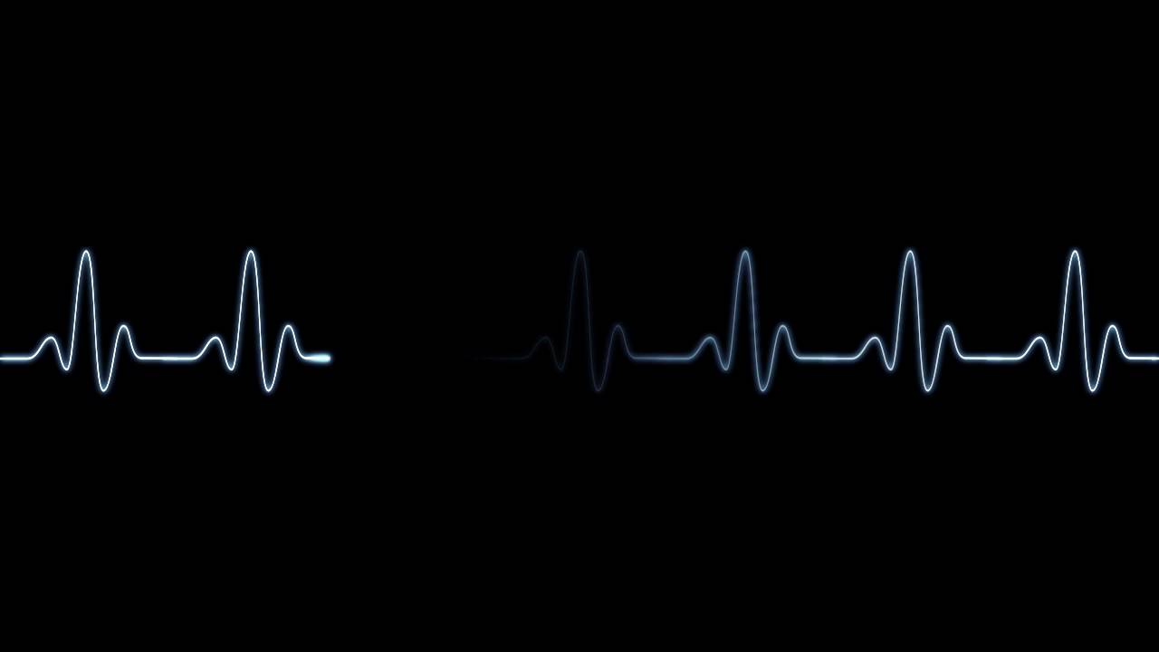 Animated clipart heartbeat