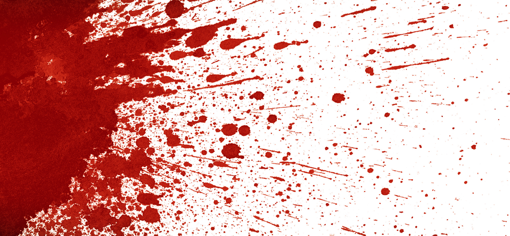 My Friend Taught Me How To Play 'The Blood Game' And I Regret Ever 