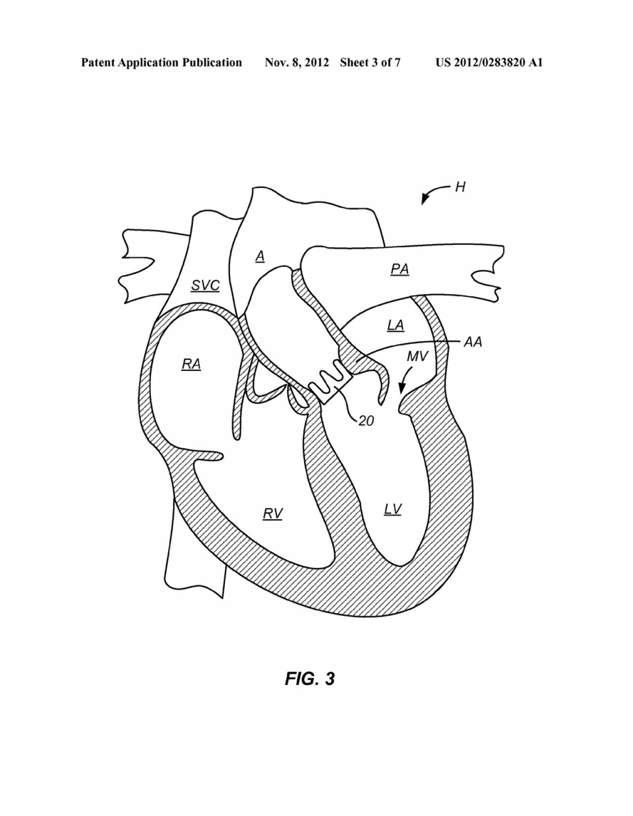 Heart Anatomy Blank