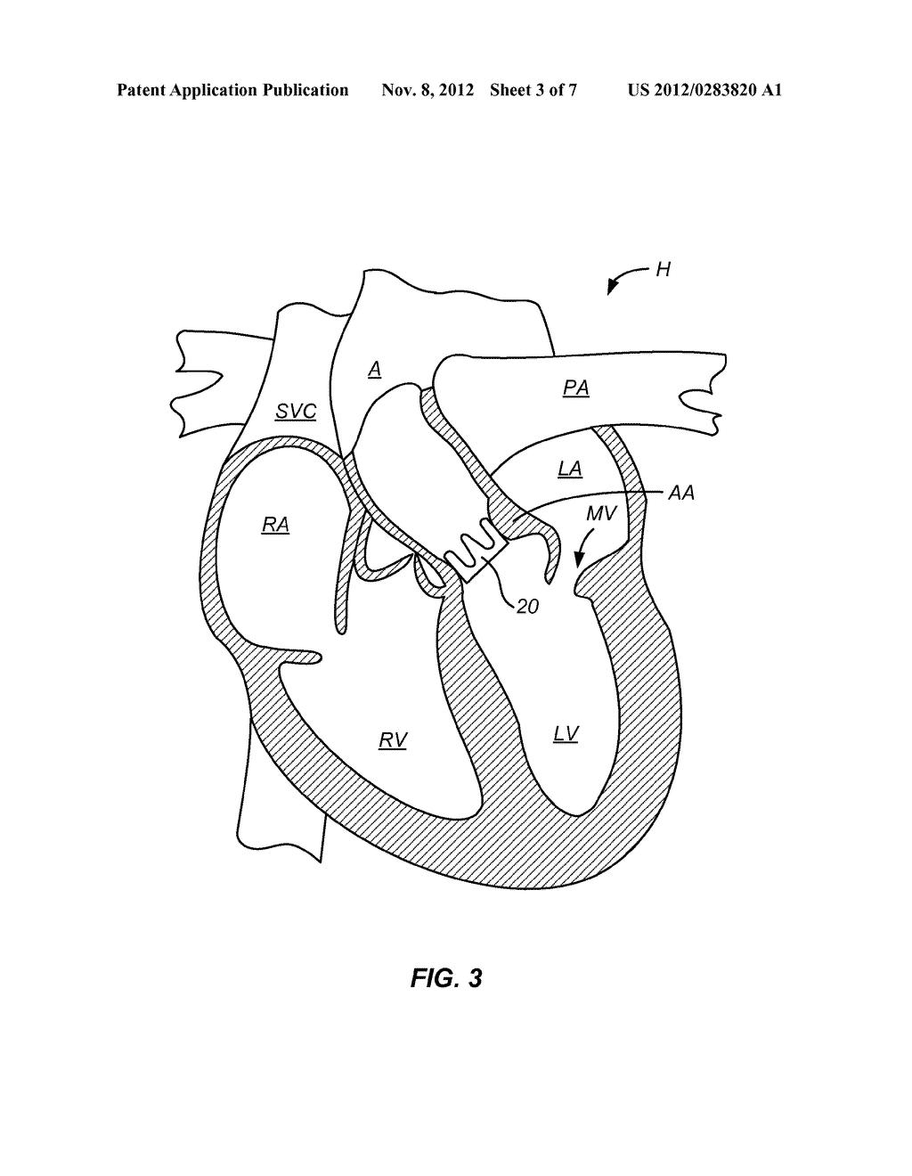 Images For  Heart Diagram Unlabeled