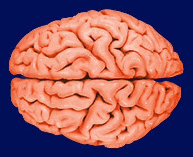 Morphonix - Wet Brain - Real human brain