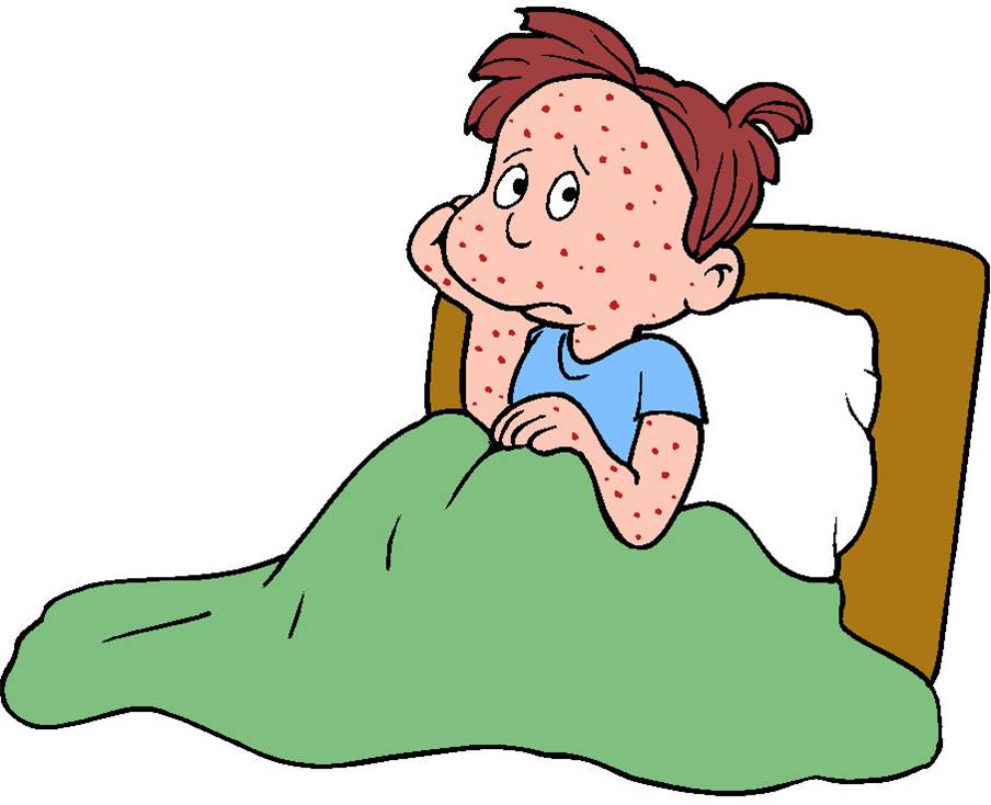 Do you have measles or chicken pox?