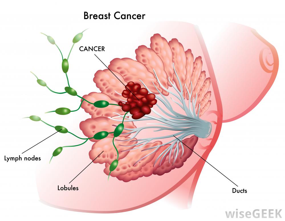 Free Breast Cancer Download Free Breast Cancer Png Images Free 