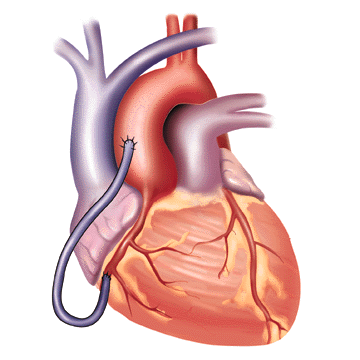 Free Heart Human, Download Free Heart Human png images, Free ClipArts on  Clipart Library