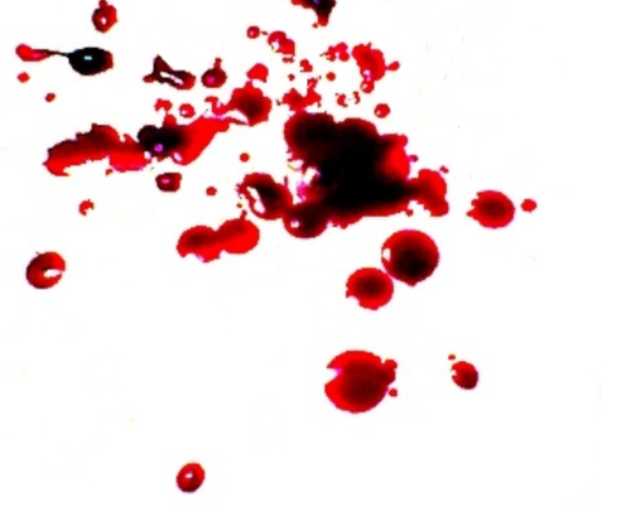 File:Blood.jpg - Wikimedia Commons