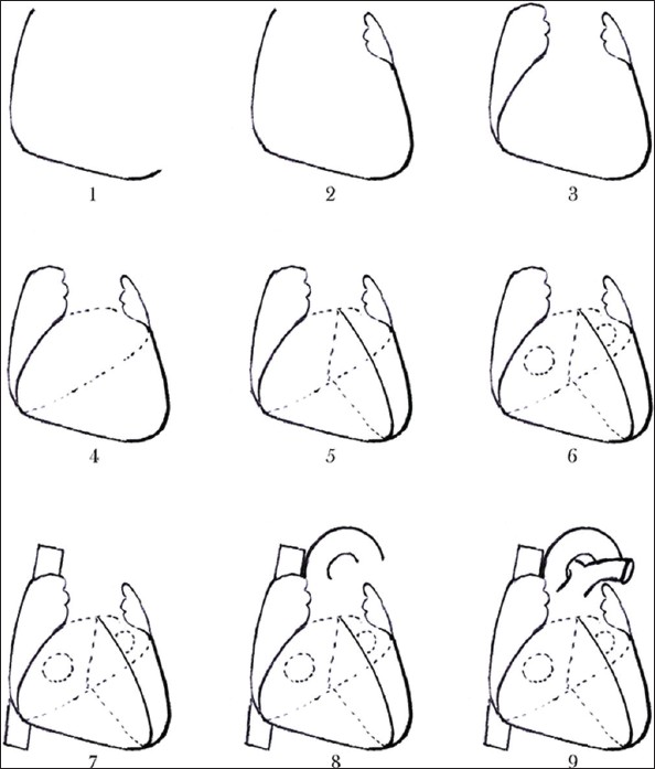 Free How To Draw A Human Heart, Download Free How To Draw A Human Heart