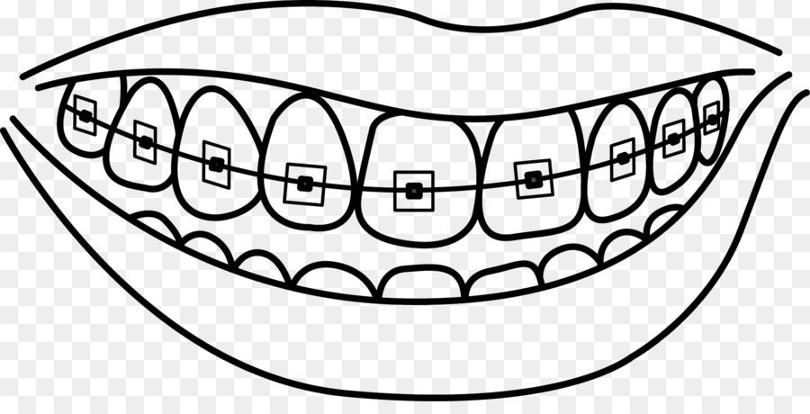 Dental braces Dentistry Human tooth Drawing - tooth cavity png download - 2044*1012 - Free Transparent  png Download.