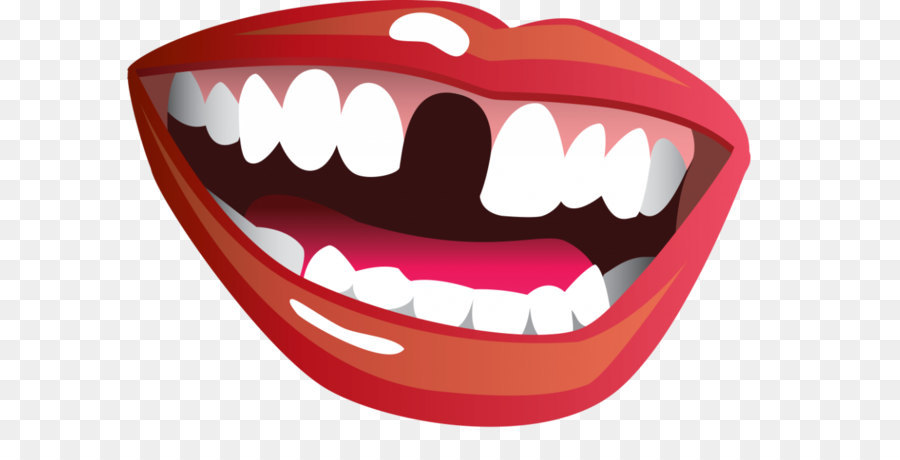 Tooth loss Mouth Smile Clip art - Smile mouth PNG png download - 1024*706 - Free Transparent  png Download.