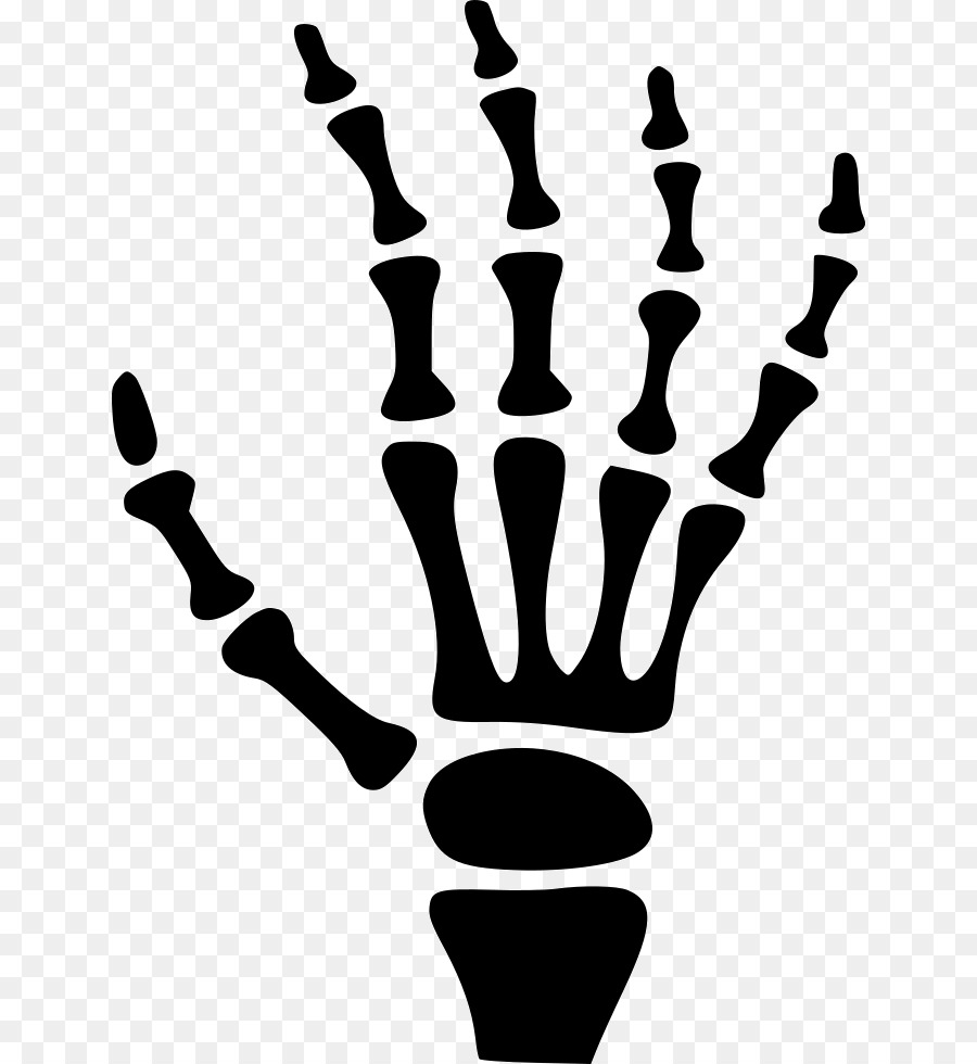Carpal bones Human skeleton Hand - hand png download - 696*980 - Free Transparent Bone png Download.