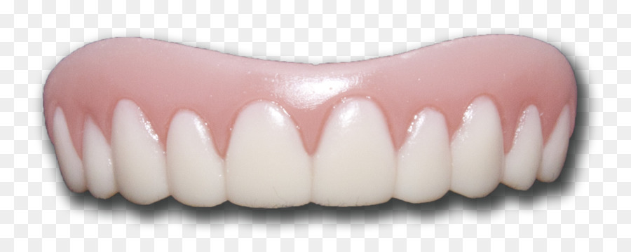 Veneer Tooth whitening Dentures Tooth pathology - Teeth PNG Transparent Images png download - 1764*696 - Free Transparent Veneer png Download.