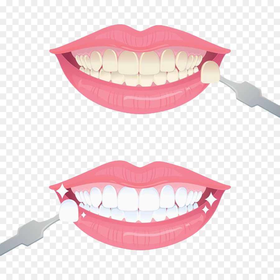Tooth whitening Euclidean vector - Hand painted teeth whitening png download - 1024*1024 - Free Transparent Tooth png Download.