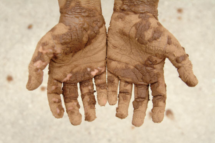 Free Dirty Hands Cliparts, Download Free Dirty Hands Cliparts png