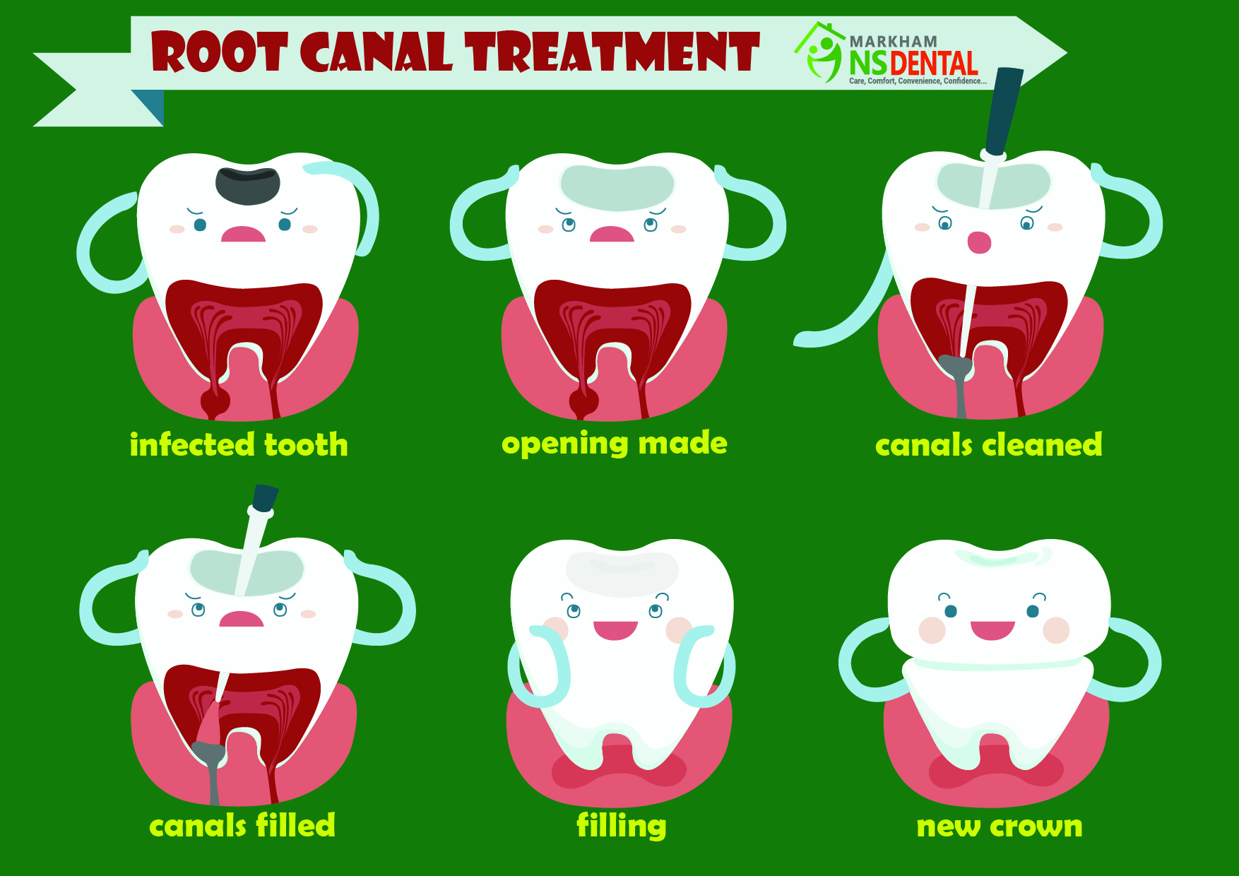 Free Root Canal Cliparts, Download Free Root Canal Cliparts png images,  Free ClipArts on Clipart Library