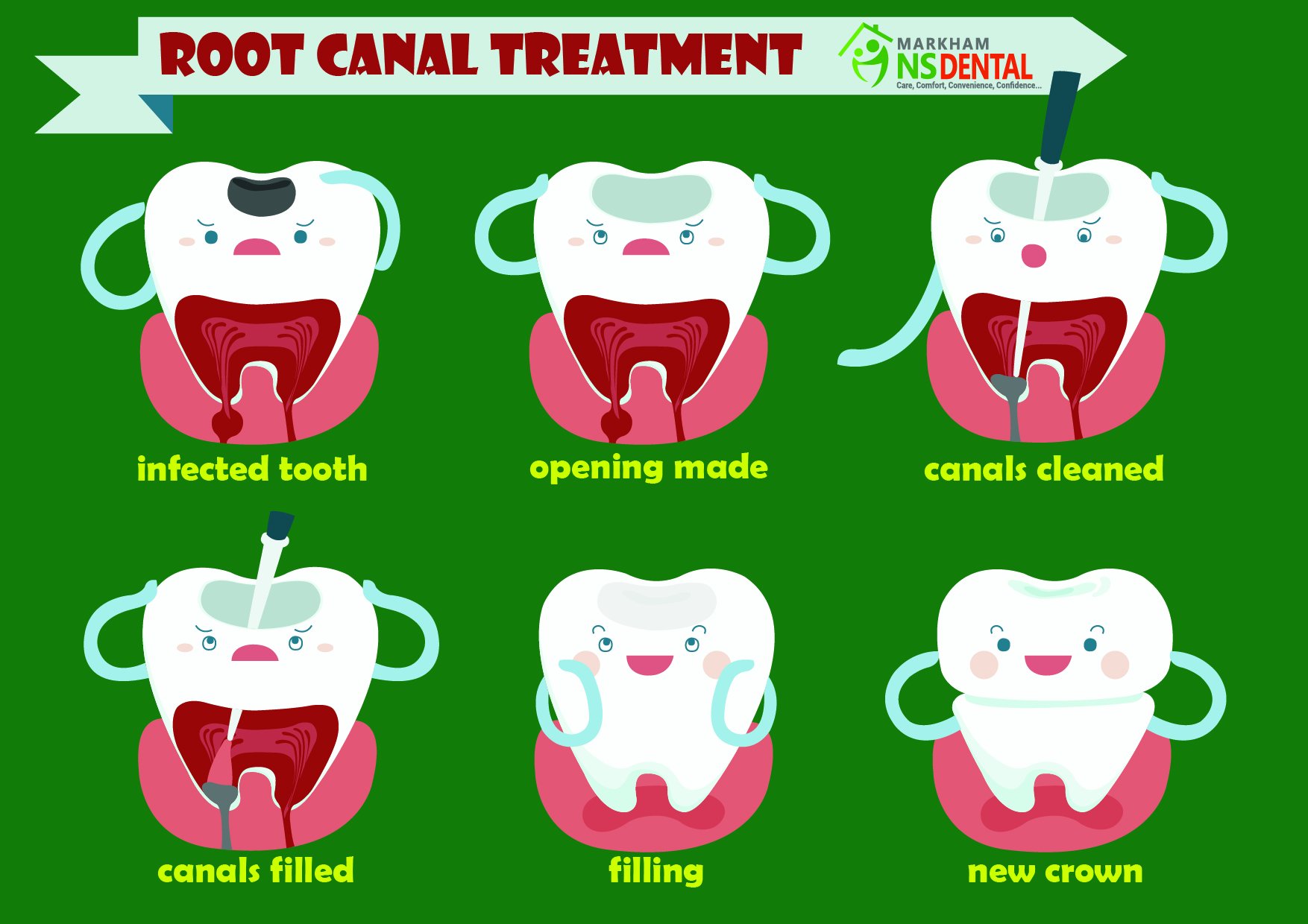 free-root-canal-cliparts-download-free-root-canal-cliparts-png-images