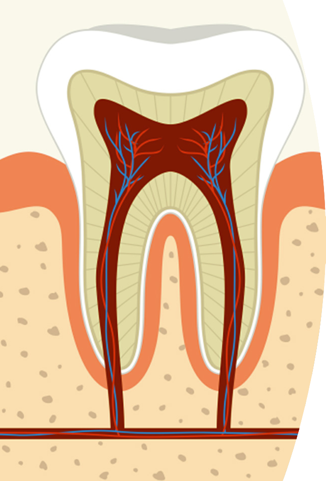 Free Root Canal Cliparts, Download Free Root Canal Cliparts png images