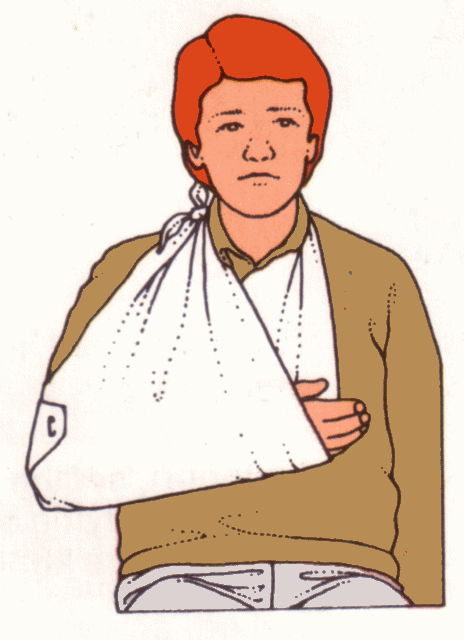 Free Cliparts Injury Sling, Download Free Cliparts Injury Sling png