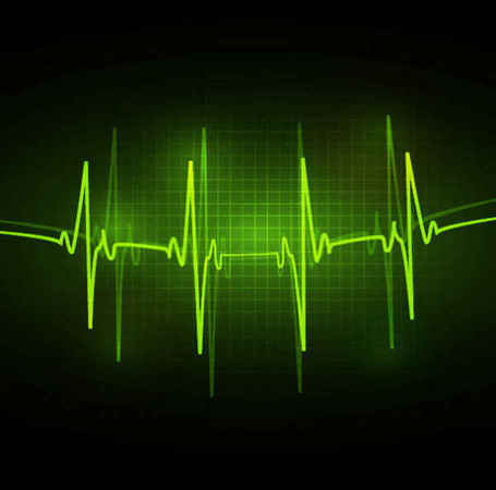 Free Flatline Ekg Cliparts Download Free Flatline Ekg Cliparts Png