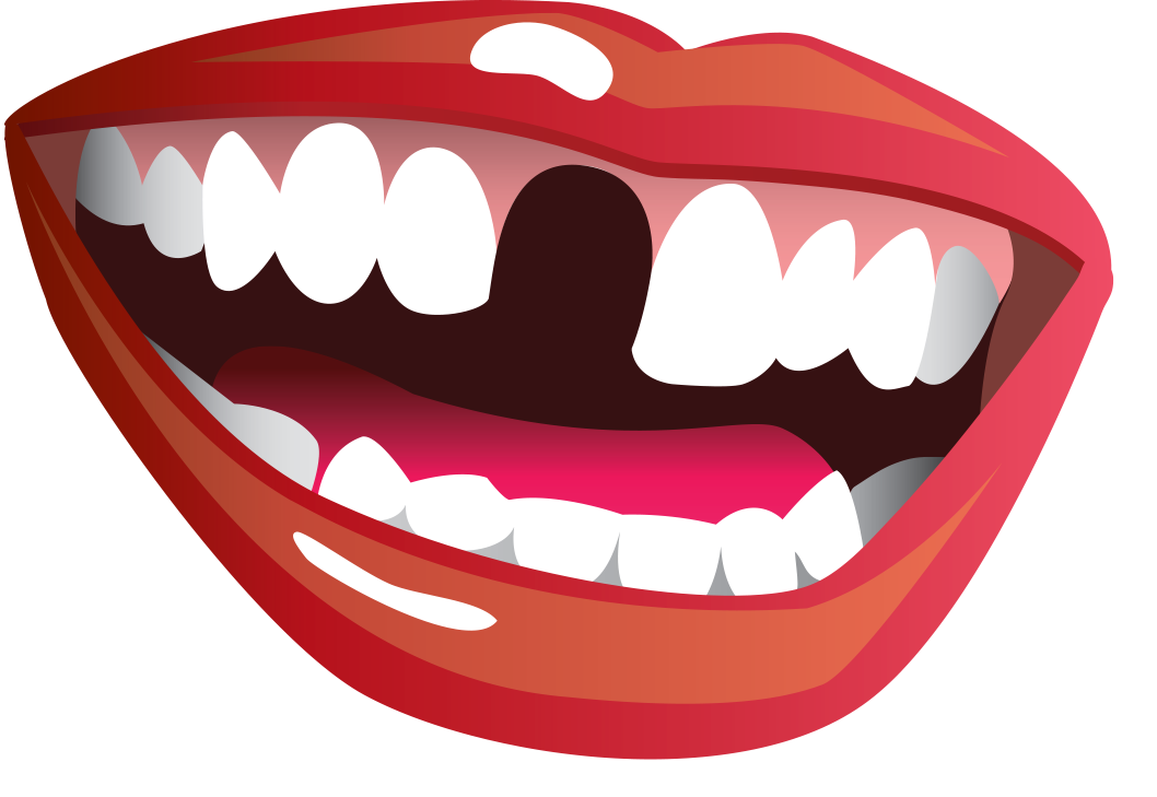 clipart missing tooth - photo #3