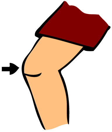 Clip Arts Related To : knee pain clipart. 