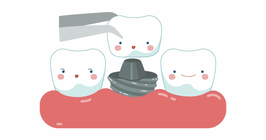 dental crown png clipart
