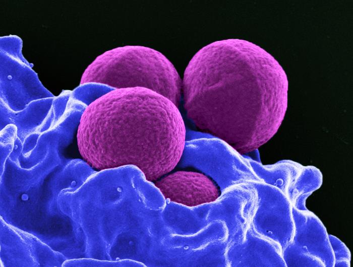Scanning electron micrograph of purple spherical cells (likely cancer or immune cells) interacting with a blue cellular surface.