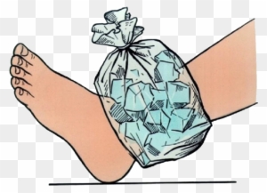 Illustration of a foot wrapped in a plastic bag filled with ice cubes for injury treatment.
