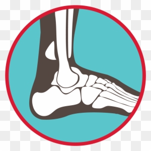 Illustration of human ankle and foot skeletal structure within a red circular border on teal background.