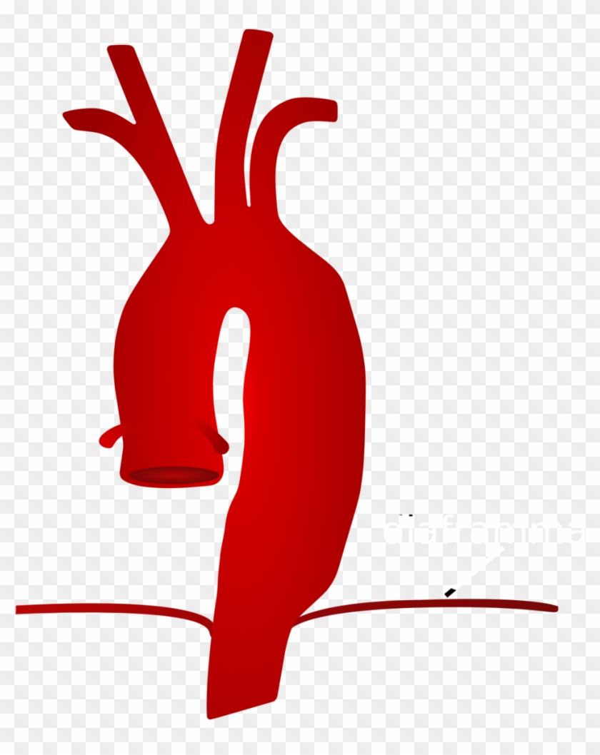 Illustration Of A Woman Suffering From Heart Pain Royalty Free SVG 
