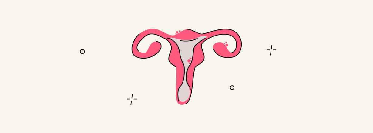 Endometriosis with Condition the Endometrium Grows Outside the 