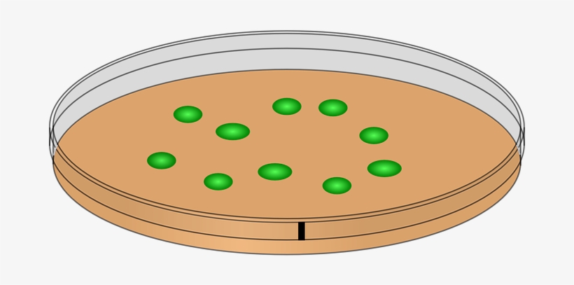 Petri dish with agar medium and green bacterial colonies, used in microbiology labs for culture analysis.