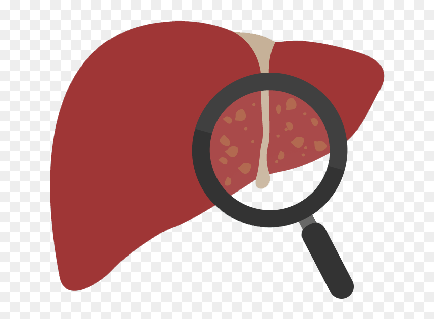 Illustration of a human liver with a magnifying glass revealing fatty deposits, symbolizing liver disease diagnosis.