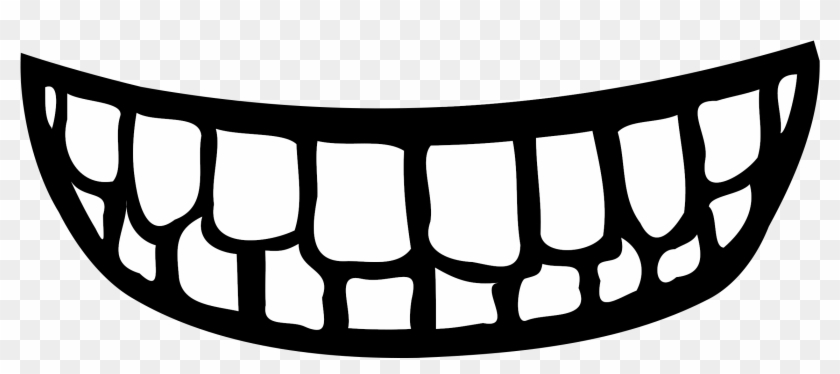 Black-and-white cartoon-style wide grin with uneven, jagged teeth on transparent background.