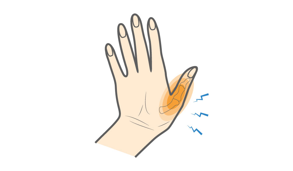 Free Sprained Finger Cliparts, Download Free Sprained Finger - Clip Art ...