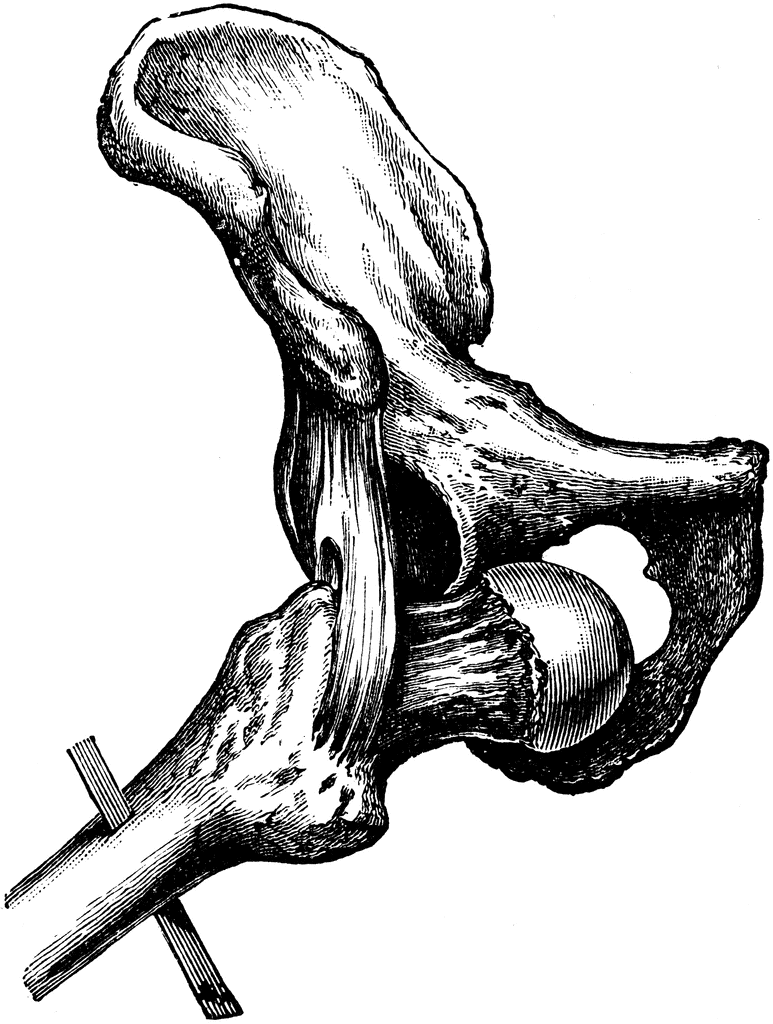 Detailed black-and-white anatomical illustration of the human hip joint, showing femur head seated in acetabulum of pelvis with ligaments.