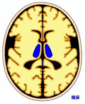 Human Brain Anatomy Diagram - Lateral Ventricles and Thalamus