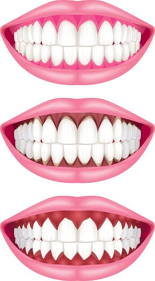 Three illustrated mouths showing healthy, crooked, and jagged teeth for dental comparison.