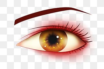 Illustration of a red, irritated human eye with visible blood vessels and inflammation, indicating conjunctivitis or eye strain.
