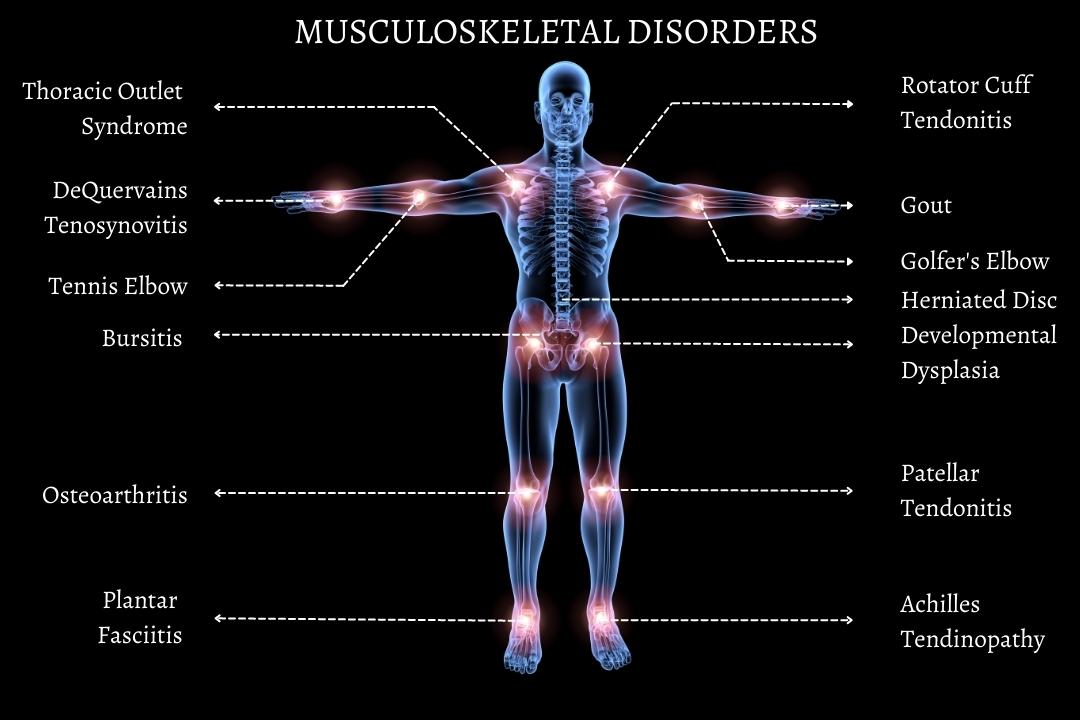 Musculoskeletal Stock Illustrations – 3,354 Musculoskeletal Stock 