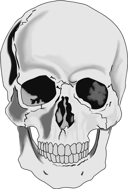 Grayscale illustration of a human skull with visible cracks and anatomical detail against black background.