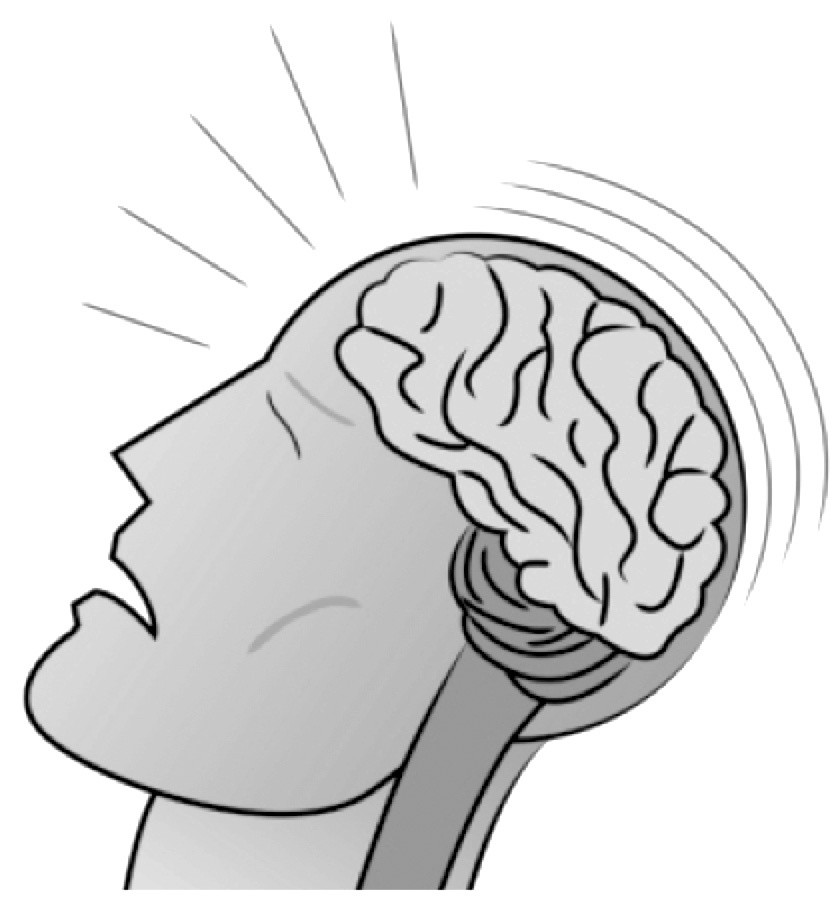 Understanding Concussion Symptoms and Brain Injury Signs