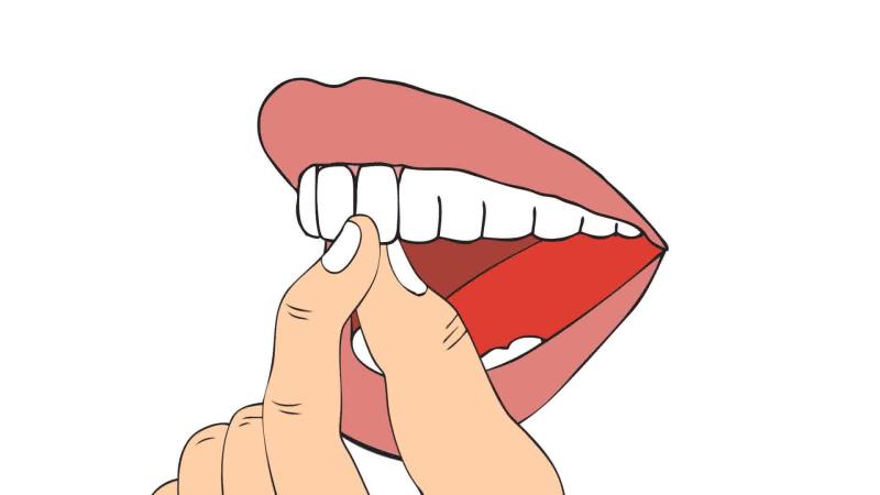 Illustration of a hand inserting a clear dental retainer onto upper teeth.