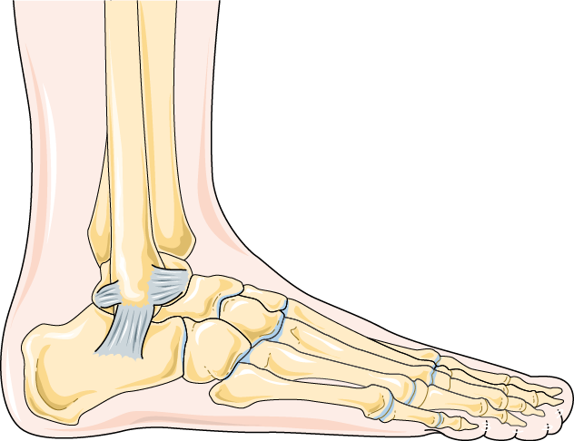 Top Ankle Sprain Stock Vectors, Illustrations & Clip Art - Clipart ...