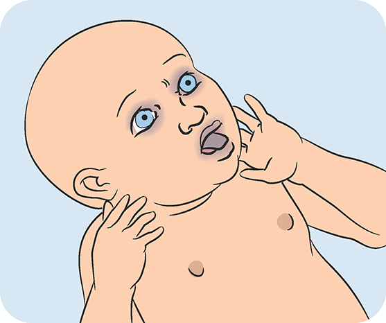 Baby with blue eyes and bald head touching face, showing curiosity or mild discomfort.
