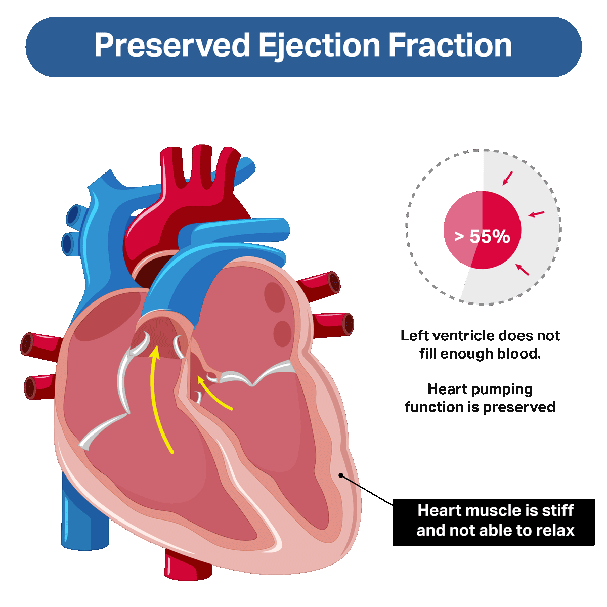 CARDIOPedVal Clip Art Library