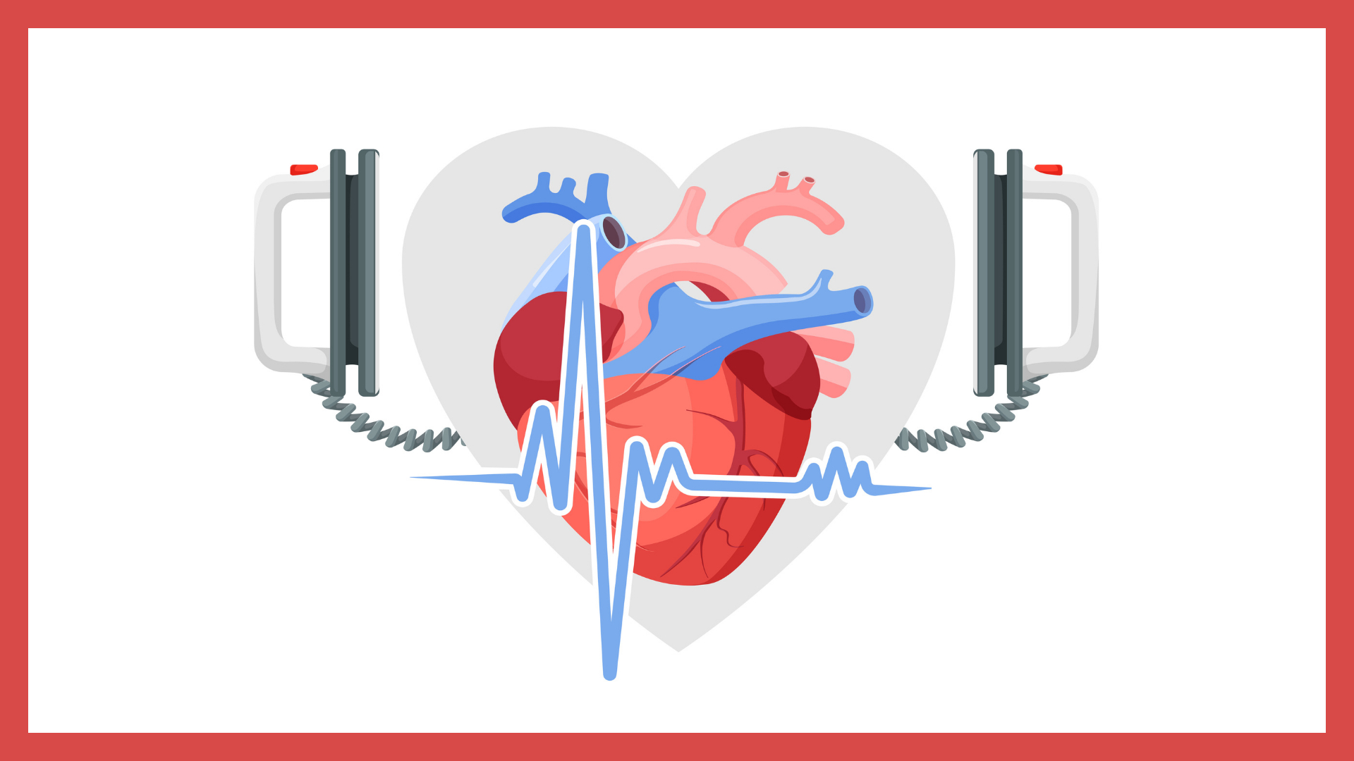 Cardiac Arrest Royalty Free SVG Cliparts Vectors And Stock Clip 