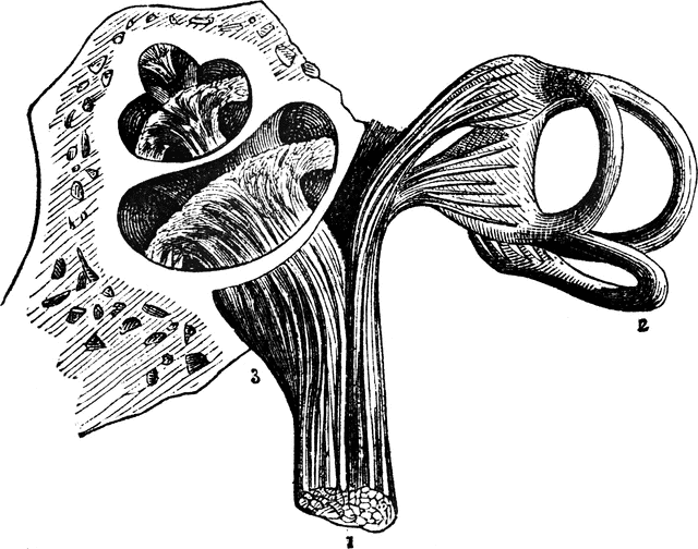 Anatomical illustration of the human inner ear, showing semicircular canals, cochlea, and vestibular structures labeled 1-3.