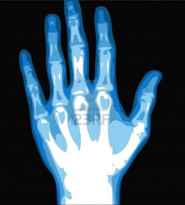 Hand X Rays Clip Art Library