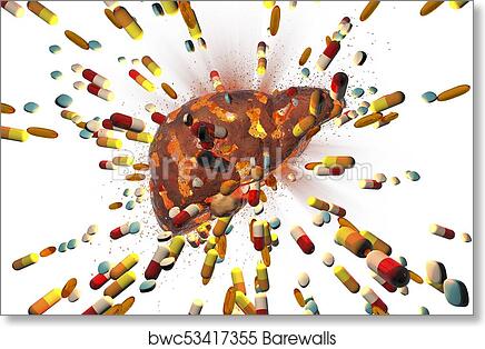 A damaged human liver surrounded by exploding pills and capsules, symbolizing drug-induced liver injury or toxicity.